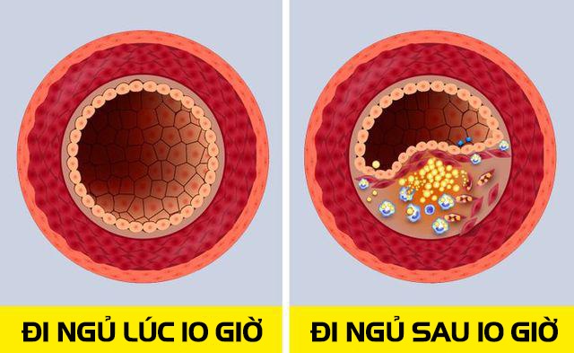 6 lý do đi ngủ lúc 10 giờ tốt hơn đi ngủ lúc 9 hay 11 giờ gấp trăm lần - 4