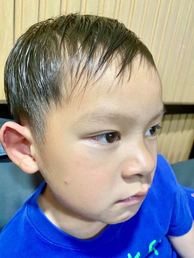 Con trai gặp nạn sưng mặt, phù tay ở nông trại nghìn m2, Lý Hải Minh Hà lên mạng cầu cứu - 1