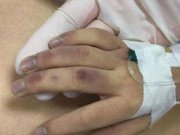 Tin tức - Vụ bé gái 6 tuổi tử vong: Vì sao người cha bị khởi tố về Tội cố ý gây thương tích?