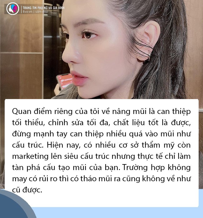 Sự thật không phải ai cũng tỏ: Nâng mũi quyết định chỉ 1% ở chất liệu - 3