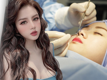 Sự thật không phải ai cũng tỏ: Nâng mũi quyết định chỉ 1% ở chất liệu