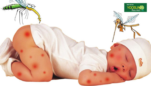 Mải chống dịch Covid 19, đừng quên phòng muỗi cho trẻ lúc giao mùa! - 1