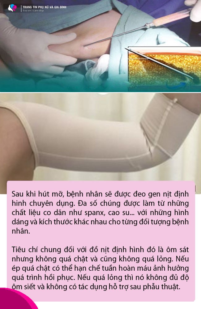 Bác sĩ nói gì về vụ đi hút mỡ tay nhận về cái kết biến dạng như teo cơ Delta - 7