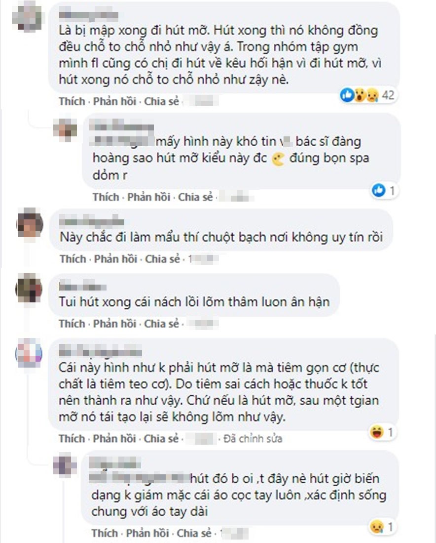 Bên dưới bài đăng, hội chị em bàn tán xôn xao. Ai nấy cho rằng, cô nàng đã đen đủi làm chuột bạch cho cơ sở thẩm mỹ không uy tín. Có người lại phản bác rằng, đây không phải là hút mỡ mà là tiêm gọn cơ. Tuy nhiên, rất nhiều chị em đã phủ nhận điều đó vì họ sau khi hút mỡ xong cũng găp tình trạng tương tự.