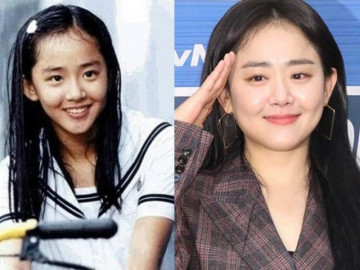 "Em gái quốc dân xứ Hàn": Mắc bệnh nguy hiểm, không thể tiếp tục đóng phim