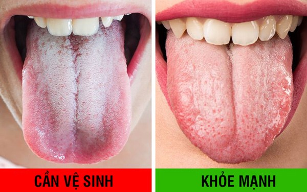 Không chỉ đánh răng, làm thêm những mẹo này thì cả đời không bao giờ cần gặp nha sĩ - 10