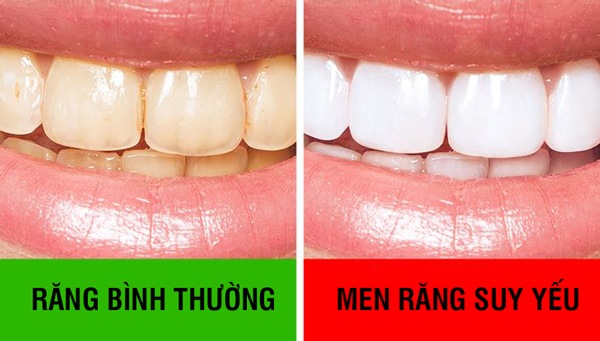 Không chỉ đánh răng, làm thêm những mẹo này thì cả đời không bao giờ cần gặp nha sĩ - 3