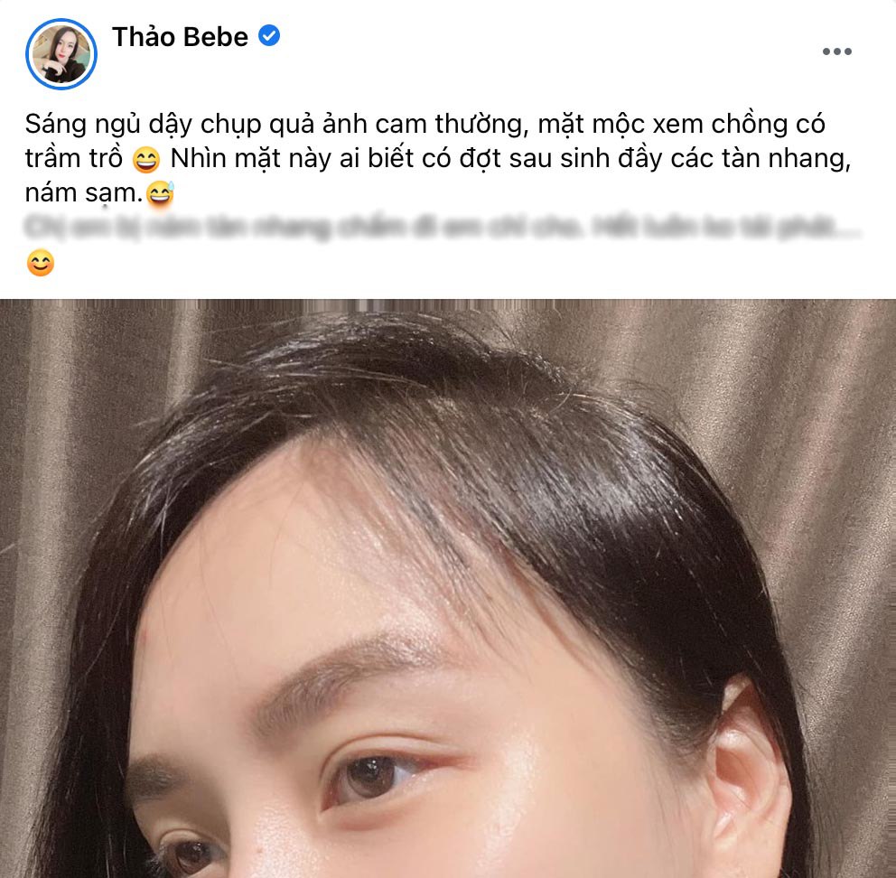 Bà xã DJ của Khắc Việt “bê” mặt mộc lên sóng: Ai nghĩ sau sinh đầy tàn nhang, nám sạm - 5