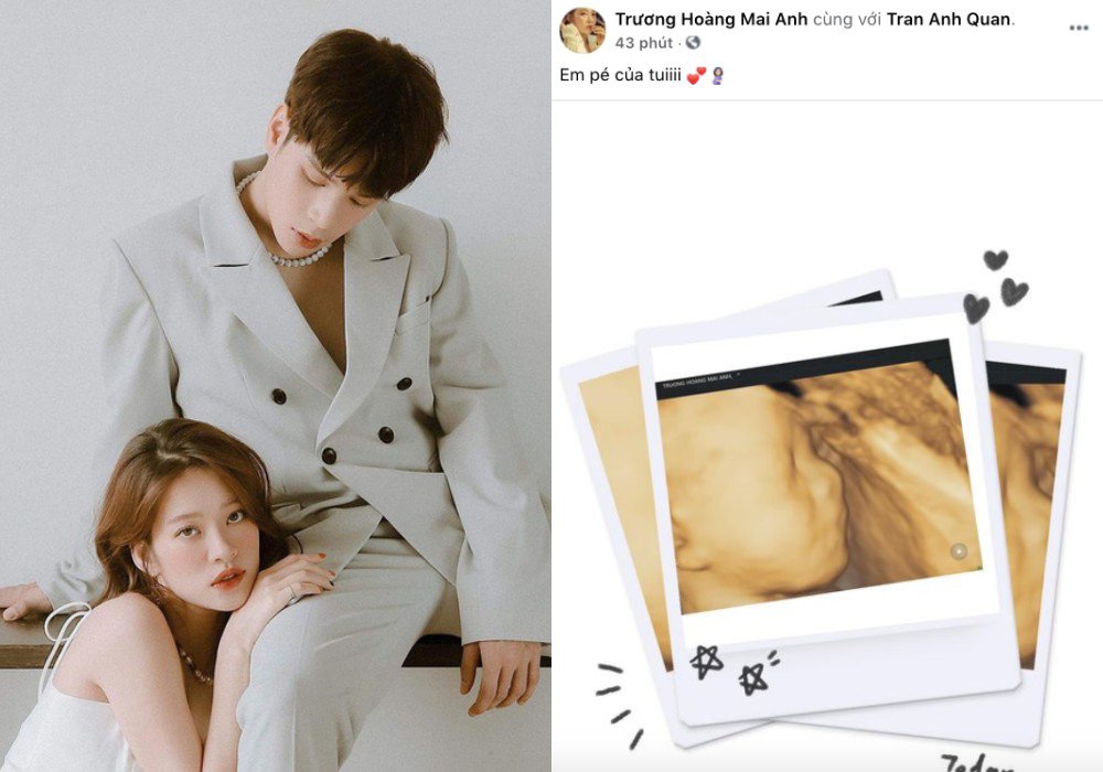 Hiện tại, Trương Hoàng Mai Anh và Jaykii chưa công bố giới tính con đầu lòng.