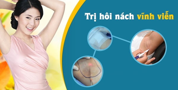 Cách trị hôi nách tại nhà bằng tự nhiên và thuốc đặc trị hiệu quả - 8