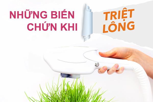 Triệt lông và những điều cần biết về triệt lông vĩnh viễn để tránh tác hại khôn lường - 4