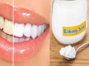 15 Cách làm trắng răng tại nhà an toàn cực hiệu quả