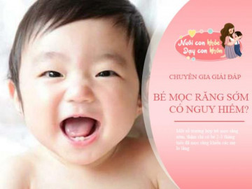 Một số trẻ mọc răng khi 4 tháng, một số trẻ chỉ mọc khi 1 tuổi, đây là lý do!