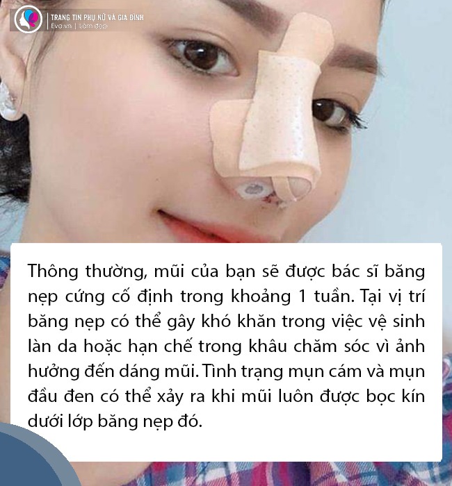 Nâng mũi xong về mụn nổi ầm ầm, chị em bình tĩnh đọc kĩ bài viết này - 5