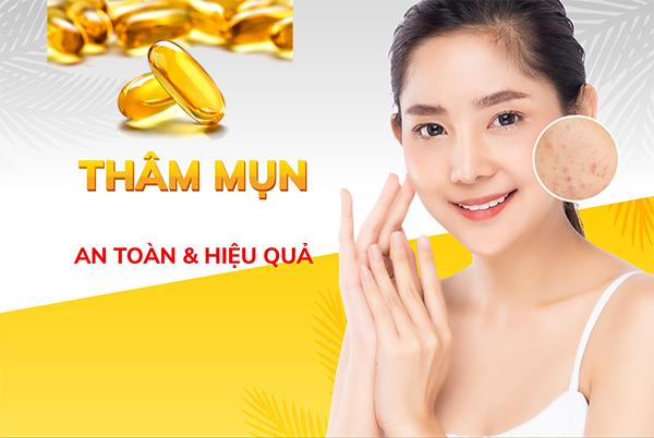 15 Cách trị thâm mụn tại nhà cấp tốc hiệu quả nhanh nhất - 7