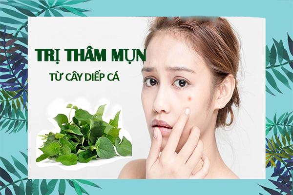 15 Cách trị thâm mụn tại nhà cấp tốc hiệu quả nhanh nhất - 5