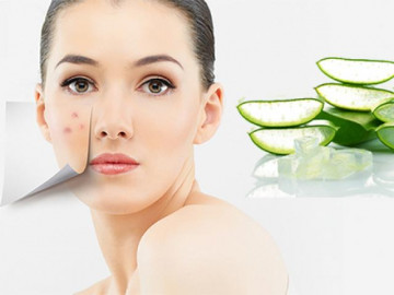 15 Cách trị thâm mụn tại nhà cấp tốc hiệu quả nhanh nhất