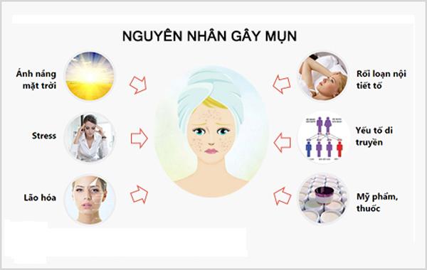 Mụn trứng cá xuất hiện do đâu và cách điều trị hiệu quả - 2