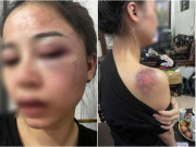 Tin tức - Tin tức 24h: Bị tố bạo hành vợ dã man từ 23h đến 4h sáng, chồng bất ngờ lên tiếng