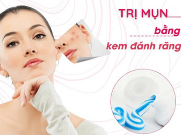Mụn trứng cá xuất hiện do đâu và cách điều trị hiệu quả