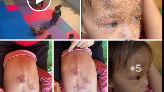 Clip bị đánh và các vết thương trên cơ thể cháu bé được lan truyền khiến cộng đồng mạng bức xúc.