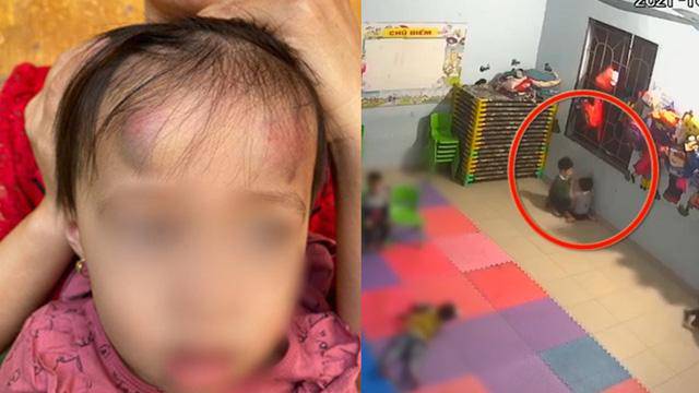 Bé gái 2 tuổi bị bạn học đánh đập dã man