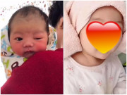 Làm mẹ - Con chào đời xấu xí, mắt to mắt bé khiến mẹ chết lặng, 1 năm sau đẹp như thiên thần