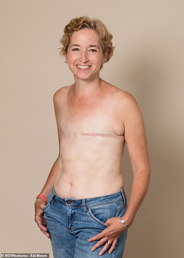 Phần đầu ti cũng bị cắt bỏ hoàn toàn. Do đó, họ buộc phải sử dụng 1 loại áo ngực giả chuyên dụng để lấp đầy khoảng trống.