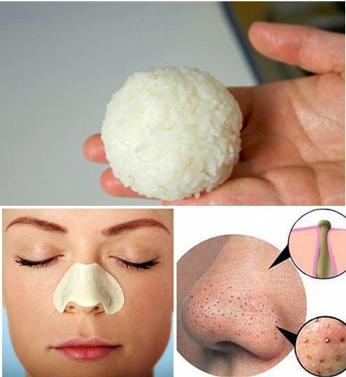 28 Mặt nạ trị mụn tốt nhất từ nguyên liệu tự nhiên an toàn và hiệu quả - 3