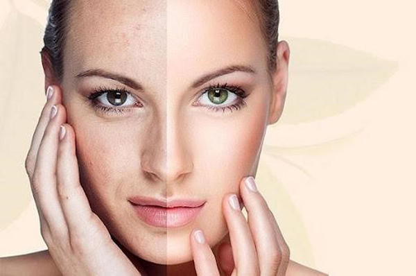 Sử dụng mỹ phẩm kém chất lượng gây nên nhiều hậu quả nghiêm trọng, trở thành nỗi ám ảnh của phái đẹp