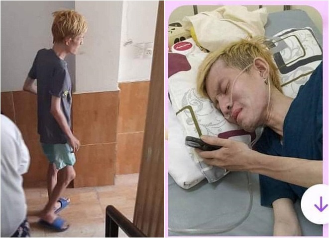 Nam ca sĩ gầy hom hem khi bị nhiều bệnh.