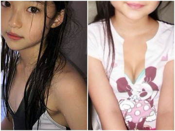 Con gái 7 tuổi dậy thì sớm vì phụ huynh bật đèn khi ngủ nhiều năm