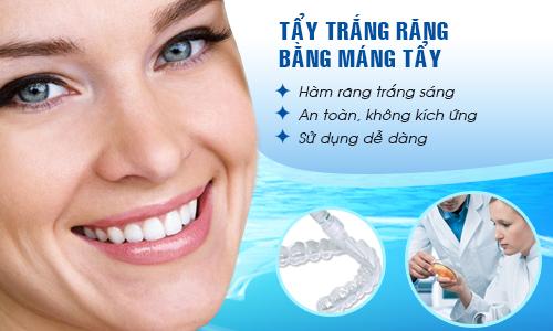 Tẩy trắng răng có hại gì với sức khỏe và những đối tượng không nên tẩy - 4