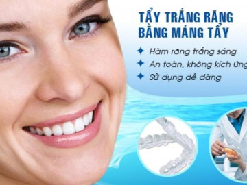 Tẩy trắng răng có hại gì với sức khỏe và những đối tượng không nên tẩy