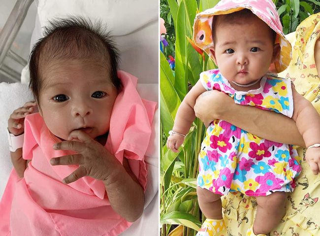 Con sinh thiếu tháng 1,39kg, da nhăn nheo, 6 tháng sau mẹ bật khóc vì may đã không vứt bỏ - 1