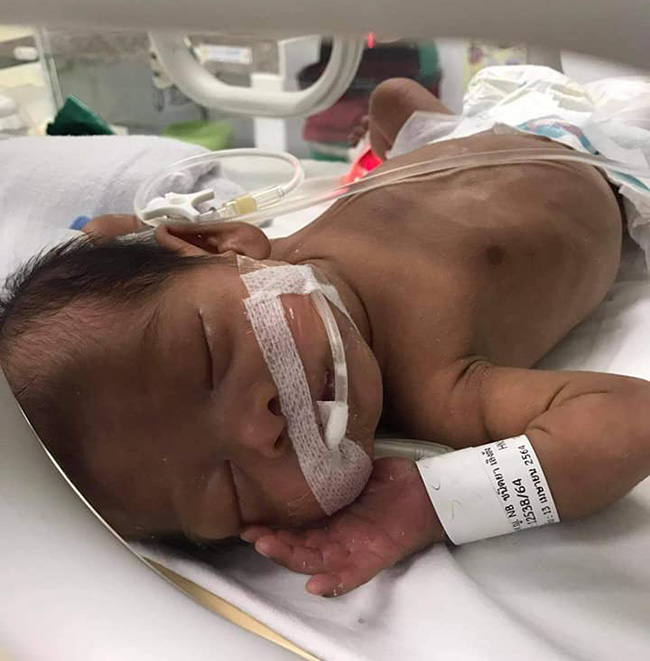 Con sinh thiếu tháng 1,39kg, da nhăn nheo, 6 tháng sau mẹ bật khóc vì may đã không vứt bỏ - 2