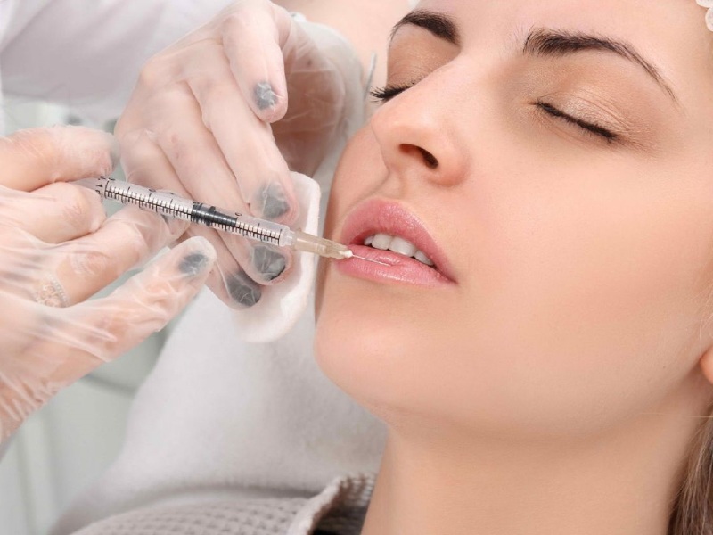 Bị nói bờ môi sưng phồng, Phương Trinh Jolie phản bác thế nào mà được khen - 17