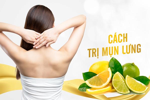 13 Cách trị mụn lưng từ nguyên liệu tự nhiên an toàn và hiệu quả nhất - 3