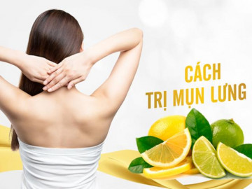 13 Cách trị mụn lưng từ nguyên liệu tự nhiên an toàn và hiệu quả nhất