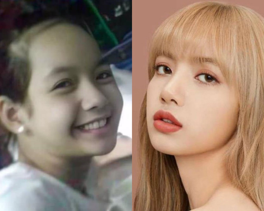 Đỉnh cao thẩm mỹ như không thẩm mỹ tại Hàn: BlackPink sửa gần hết, riêng Lisa tiêu gần 1 tỷ - 4