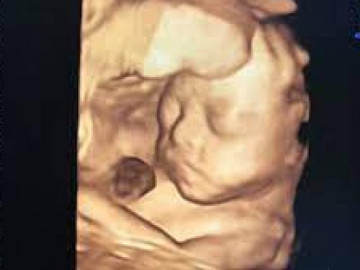 Thai 19 tuần nặng bao nhiêu gam là đúng chuẩn?