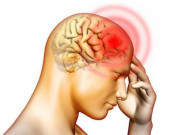 Sức khỏe - Người bị thiếu máu não nên ăn gì và không nên ăn gì?