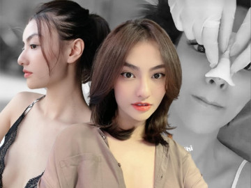 Chân dài xinh đẹp vẫn sợ lão hoá, làm mũi collagen để luôn tươi trẻ