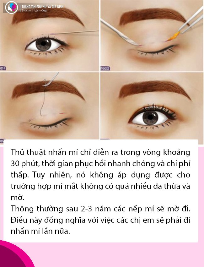 Bất ngờ với tin Thúy Vi dao kéo lần thứ n, nhan sắc làm đi làm lại liệu còn đẹp? - 4