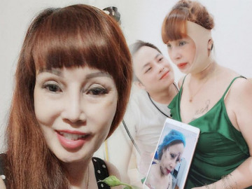 Phẫu thuật thẩm mỹ hết mặt cô dâu 62 tuổi vẫn bị da nhăn nheo chảy xệ