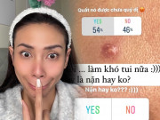 Làm đẹp - Võ Hoàng Yến nặn mụn cũng hỏi ý kiến cư dân mạng