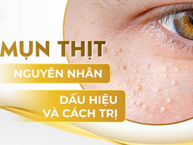 11 Cách trị mụn thịt tận gốc tại nhà an toàn hiệu quả nhanh nhất