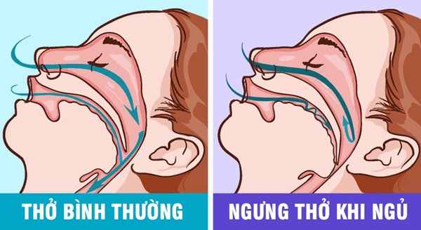 Làm điều sung sướng này với amp;#34;nửa kiaamp;#34; mỗi đêm có thể giúp cứu sống bạn, tăng cường trí nhớ - 4