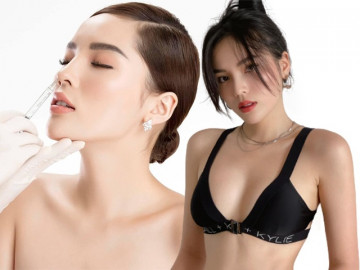 Hoa hậu như Kỳ Duyên cũng phải tiêm thứ này vào mặt để đẹp hơn