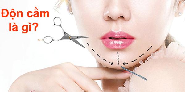 Độn cằm V Line là gì? Độn cằm có đau và nguy hiểm không? - 1